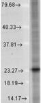 Synaptosome Associated Protein 25 antibody, NB600-692, Novus Biologicals, Western Blot image 