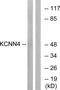 Potassium Calcium-Activated Channel Subfamily N Member 4 antibody, GTX87069, GeneTex, Western Blot image 