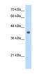 Kynurenine Aminotransferase 3 antibody, orb324842, Biorbyt, Western Blot image 