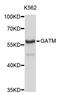 Glycine Amidinotransferase antibody, abx126917, Abbexa, Western Blot image 