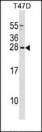 Forkhead Box O3 antibody, orb47943, Biorbyt, Western Blot image 