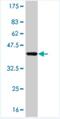 Phosphatidylinositol-4,5-Bisphosphate 3-Kinase Catalytic Subunit Gamma antibody, H00005294-M02, Novus Biologicals, Western Blot image 