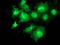 Microtubule-associated protein RP/EB family member 2 antibody, LS-C785971, Lifespan Biosciences, Immunofluorescence image 