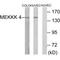 Mitogen-Activated Protein Kinase Kinase Kinase Kinase 4 antibody, A02829, Boster Biological Technology, Western Blot image 