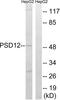 Proteasome 26S Subunit, Non-ATPase 12 antibody, LS-C119608, Lifespan Biosciences, Western Blot image 