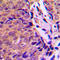 Aryl Hydrocarbon Receptor antibody, LS-C354258, Lifespan Biosciences, Immunohistochemistry paraffin image 
