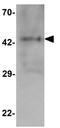 Mitochondrial Transcription Termination Factor 4 antibody, GTX32113, GeneTex, Western Blot image 