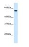 Formimidoyltransferase Cyclodeaminase antibody, NBP1-54997, Novus Biologicals, Western Blot image 