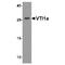 Vesicle Transport Through Interaction With T-SNAREs 1A antibody, TA349197, Origene, Western Blot image 