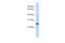 Reticulon 1 antibody, 26-430, ProSci, Enzyme Linked Immunosorbent Assay image 