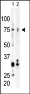 Serine/threonine-protein kinase PLK3 antibody, 63-364, ProSci, Western Blot image 