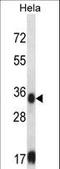 Sorbitol Dehydrogenase antibody, LS-C161392, Lifespan Biosciences, Western Blot image 