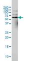 Nuclear receptor coactivator 4 antibody, H00008031-M02, Novus Biologicals, Western Blot image 