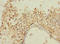 MLLT10 Histone Lysine Methyltransferase DOT1L Cofactor antibody, A62962-100, Epigentek, Immunohistochemistry paraffin image 