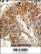 Proteasome 26S Subunit, Non-ATPase 11 antibody, 61-518, ProSci, Immunohistochemistry paraffin image 