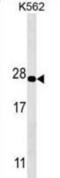 Proteasome Subunit Alpha 5 antibody, abx025406, Abbexa, Western Blot image 