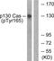 BCAR1 Scaffold Protein, Cas Family Member antibody, PA5-38377, Invitrogen Antibodies, Western Blot image 