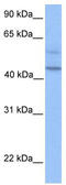 Programmed Cell Death 2 Like antibody, TA339771, Origene, Western Blot image 