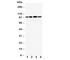 Nuclear Receptor Subfamily 3 Group C Member 2 antibody, R30672, NSJ Bioreagents, Western Blot image 