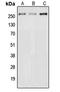 Neuron Navigator 3 antibody, LS-C353851, Lifespan Biosciences, Western Blot image 