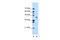 Phosphoglycerate Kinase 1 antibody, 30-363, ProSci, Western Blot image 