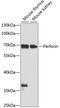 Perforin 1 antibody, 13-029, ProSci, Western Blot image 