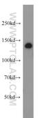 Activity Dependent Neuroprotector Homeobox antibody, 17987-1-AP, Proteintech Group, Western Blot image 