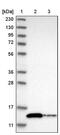 Thioredoxin Domain Containing 17 antibody, PA5-54639, Invitrogen Antibodies, Western Blot image 