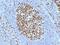 Minichromosome Maintenance Complex Component 7 antibody, M01649, Boster Biological Technology, Immunohistochemistry paraffin image 