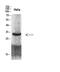Cyclin Dependent Kinase 6 antibody, STJ98721, St John