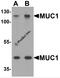 Mucin 1, Cell Surface Associated antibody, 7451, ProSci, Western Blot image 