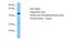 KROX20 antibody, P100880_P050, Aviva Systems Biology, Western Blot image 