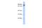 Tripartite Motif Containing 67 antibody, A16666, Boster Biological Technology, Western Blot image 