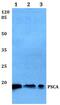 Prostate Stem Cell Antigen antibody, PA5-75178, Invitrogen Antibodies, Western Blot image 