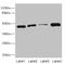 Inositol-Tetrakisphosphate 1-Kinase antibody, LS-C675922, Lifespan Biosciences, Western Blot image 