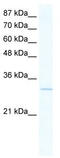 Vestigial Like Family Member 1 antibody, TA339486, Origene, Western Blot image 