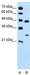 Claudin-18 antibody, TA346056, Origene, Western Blot image 