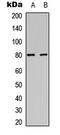 Protein Kinase C Alpha antibody, LS-C368487, Lifespan Biosciences, Western Blot image 