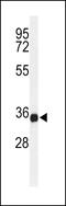 Transmembrane Protein 173 antibody, 64-236, ProSci, Western Blot image 