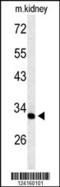 Transmembrane And Ubiquitin Like Domain Containing 2 antibody, 64-045, ProSci, Western Blot image 