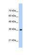 TRNA Selenocysteine 1 Associated Protein 1 antibody, orb324907, Biorbyt, Western Blot image 