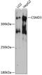 CUB And Sushi Multiple Domains 3 antibody, A10005, Boster Biological Technology, Western Blot image 
