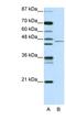 Tripartite Motif Containing 14 antibody, NB110-40872, Novus Biologicals, Western Blot image 