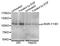 Insulin Receptor antibody, STJ22190, St John