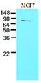 Tyrosyl-DNA Phosphodiesterase 1 antibody, MBS200157, MyBioSource, Western Blot image 