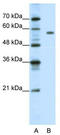 PBX Homeobox 2 antibody, TA335814, Origene, Western Blot image 