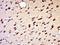 Hyaluronan Synthase 2 antibody, orb157430, Biorbyt, Immunohistochemistry paraffin image 