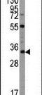 Ubiquitin Domain Containing 1 antibody, PA5-11220, Invitrogen Antibodies, Western Blot image 