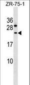 Coiled-Coil Domain Containing 140 antibody, LS-C168401, Lifespan Biosciences, Western Blot image 