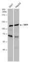 Staphylococcal Nuclease And Tudor Domain Containing 1 antibody, GTX130135, GeneTex, Western Blot image 